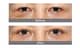 Slider image (10) HERSHE Plastic Surgery and Dermatology